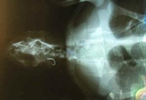 魚釣鉤之X-ray照片